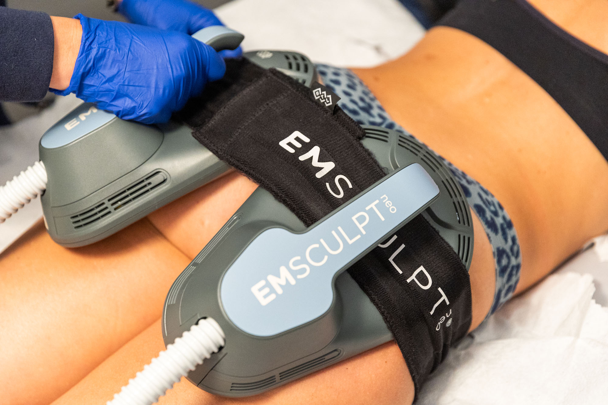 emsculptbehandelingen van Luna Wellness